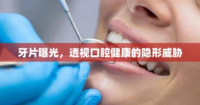 牙片曝光，透視口腔健康的隱形威脅