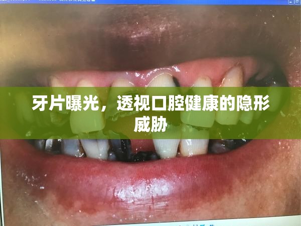 牙片曝光，透視口腔健康的隱形威脅