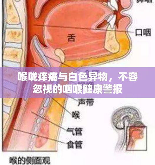 喉嚨癢痛與白色異物，不容忽視的咽喉健康警報(bào)