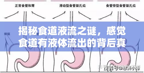揭秘食道液流之謎，感覺食道有液體流出的背后真相