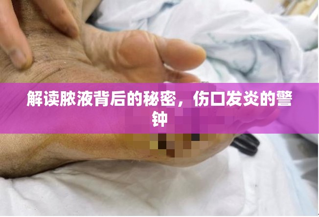 解讀膿液背后的秘密，傷口發(fā)炎的警鐘