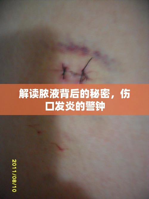 解讀膿液背后的秘密，傷口發(fā)炎的警鐘