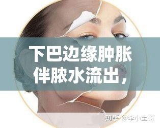 下巴邊緣腫脹伴膿水流出，不容忽視的面部健康警報(bào)