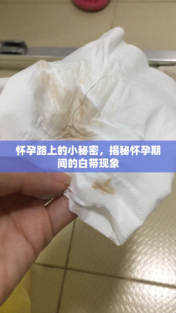 懷孕路上的小秘密，揭秘懷孕期間的白帶現(xiàn)象