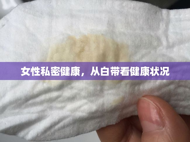 女性私密健康，從白帶看健康狀況
