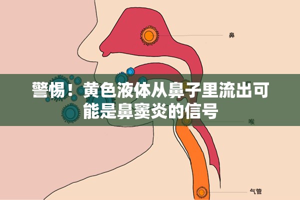 警惕！黃色液體從鼻子里流出可能是鼻竇炎的信號