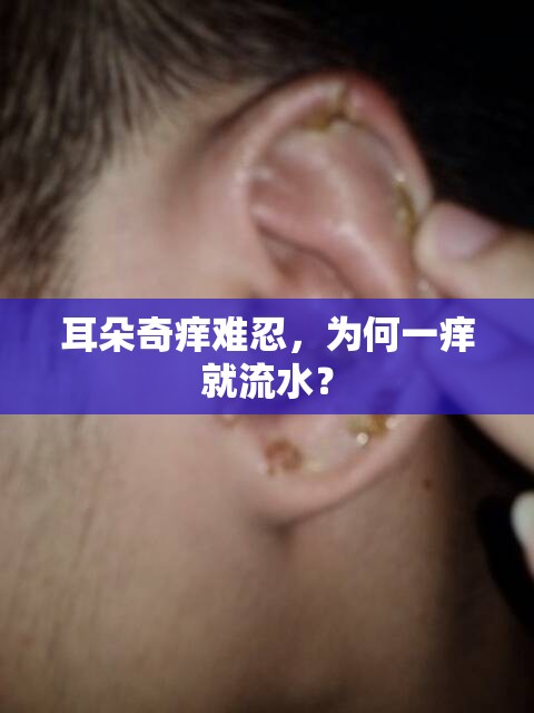 耳朵奇癢難忍，為何一癢就流水？