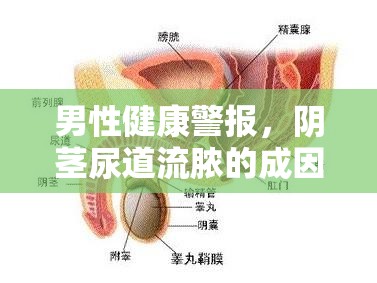 男性健康警報(bào)，陰莖尿道流膿的成因與預(yù)防