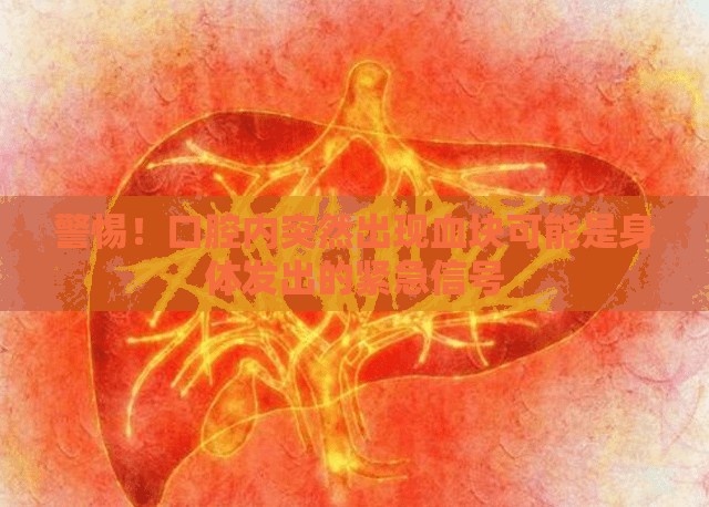 警惕！口腔內(nèi)突然出現(xiàn)血塊可能是身體發(fā)出的緊急信號