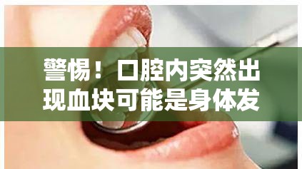 警惕！口腔內(nèi)突然出現(xiàn)血塊可能是身體發(fā)出的緊急信號
