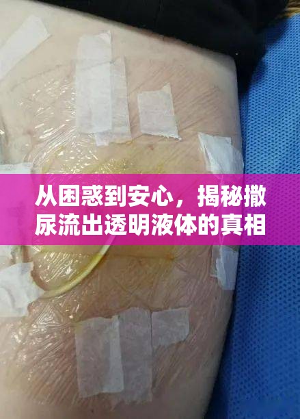 從困惑到安心，揭秘撒尿流出透明液體的真相與應(yīng)對(duì)策略