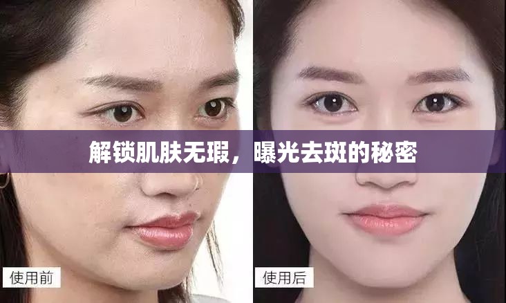 解鎖肌膚無瑕，曝光去斑的秘密