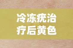 冷凍疣治療后黃色液體真相揭秘，了解那股黃色警報(bào)