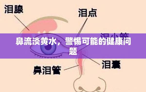 鼻流淡黃水，警惕可能的健康問題