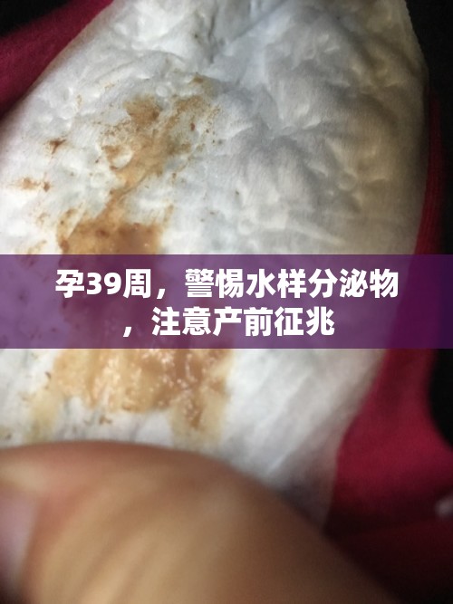 孕39周，警惕水樣分泌物，注意產(chǎn)前征兆