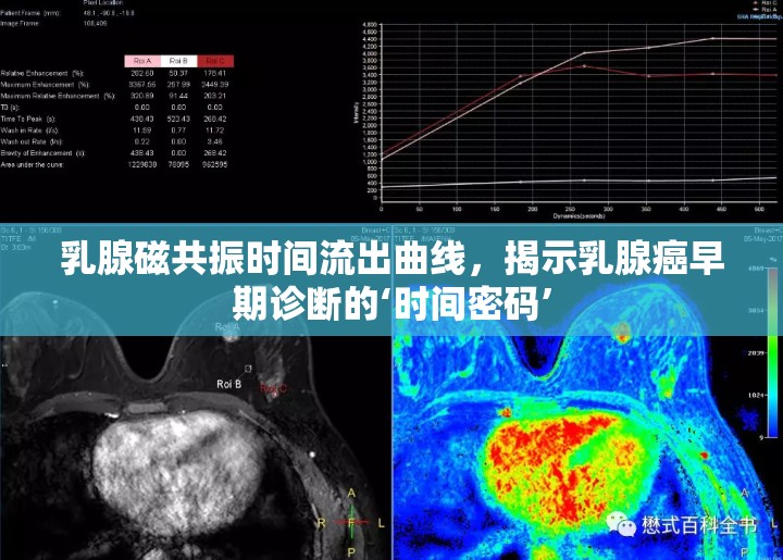 乳腺磁共振時間流出曲線，揭示乳腺癌早期診斷的‘時間密碼’