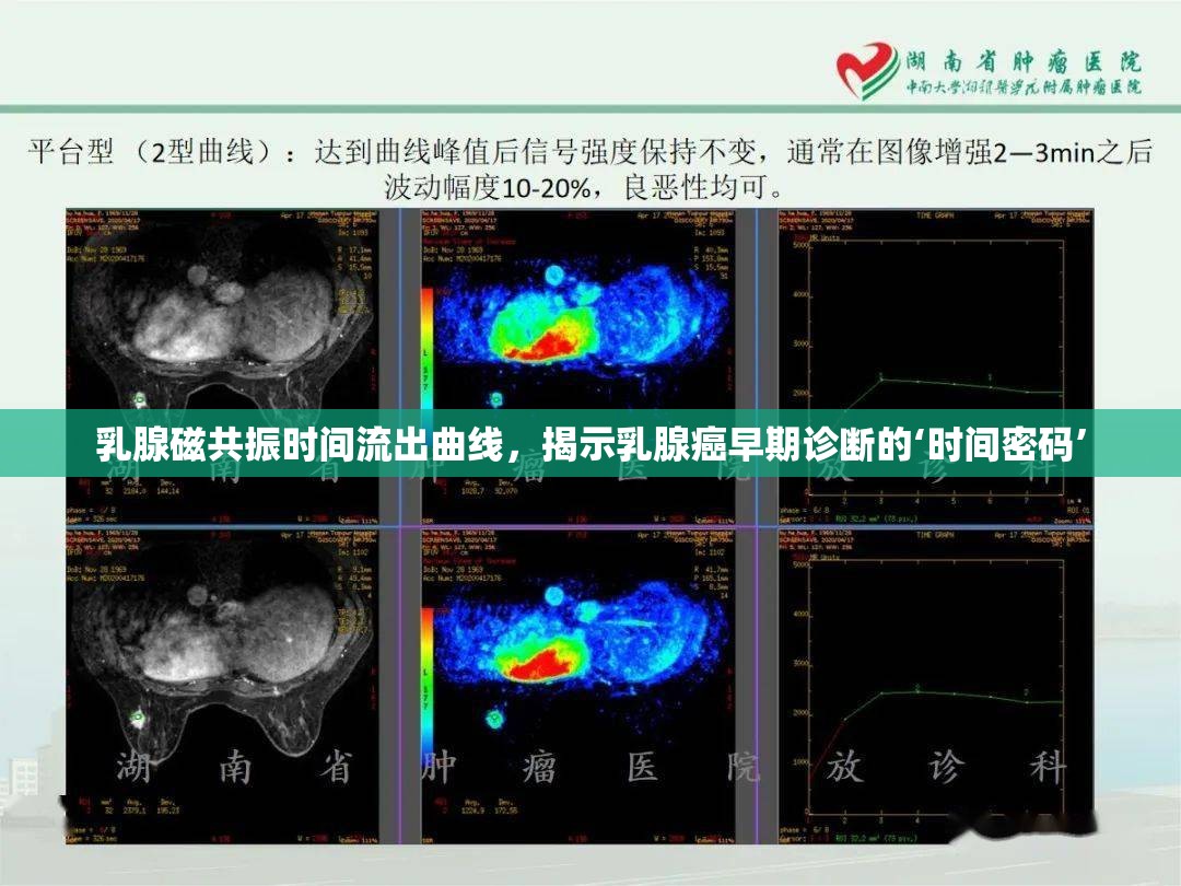 乳腺磁共振時間流出曲線，揭示乳腺癌早期診斷的‘時間密碼’