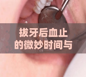 拔牙后血止的微妙時(shí)間與愈合平衡