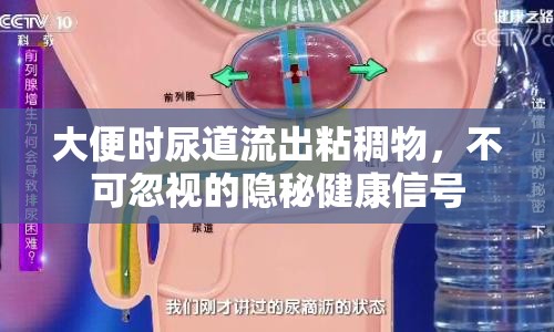 大便時(shí)尿道流出粘稠物，不可忽視的隱秘健康信號(hào)