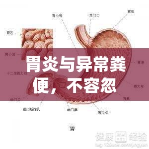 胃炎與異常糞便，不容忽視的消化系統(tǒng)警示信號(hào)