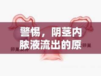 警惕，陰莖內(nèi)膿液流出的原因、癥狀與應(yīng)對措施