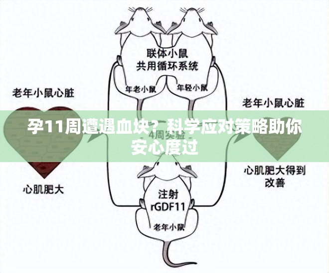 孕11周遭遇血塊？科學(xué)應(yīng)對(duì)策略助你安心度過