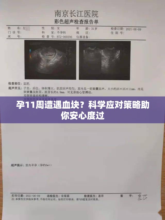 孕11周遭遇血塊？科學(xué)應(yīng)對(duì)策略助你安心度過
