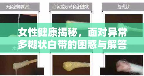 女性健康揭秘，面對異常多糊狀白帶的困惑與解答