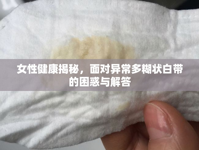 女性健康揭秘，面對異常多糊狀白帶的困惑與解答