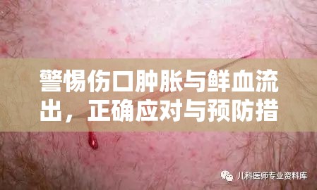 警惕傷口腫脹與鮮血流出，正確應(yīng)對(duì)與預(yù)防措施