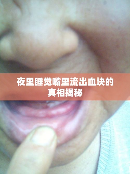夜里睡覺嘴里流出血塊的真相揭秘