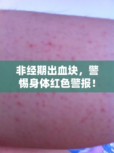 非經期出血塊，警惕身體紅色警報！