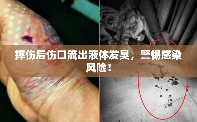摔傷后傷口流出液體發(fā)臭，警惕感染風(fēng)險(xiǎn)！