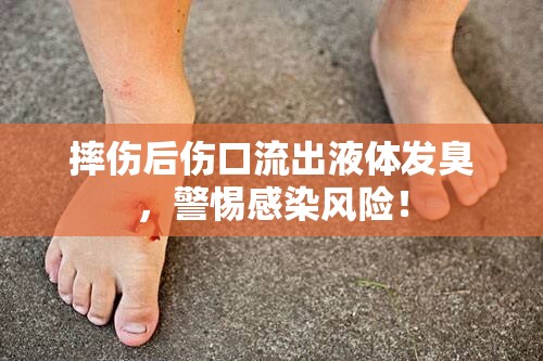 摔傷后傷口流出液體發(fā)臭，警惕感染風(fēng)險(xiǎn)！