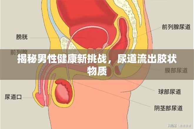 揭秘男性健康新挑戰(zhàn)，尿道流出膠狀物質(zhì)