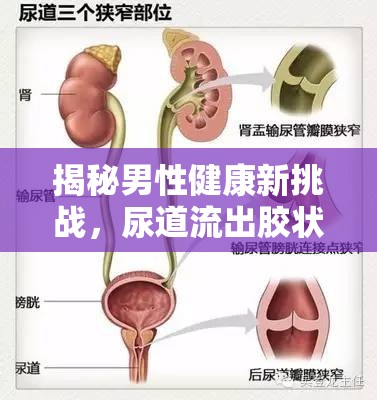 揭秘男性健康新挑戰(zhàn)，尿道流出膠狀物質(zhì)