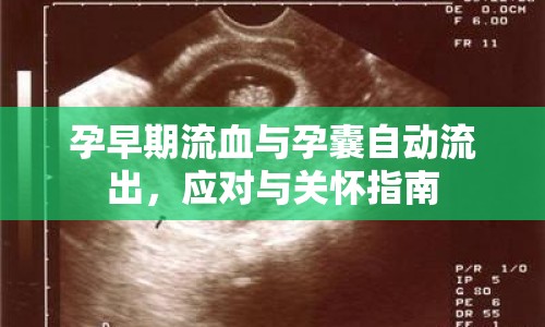 孕早期流血與孕囊自動(dòng)流出，應(yīng)對(duì)與關(guān)懷指南