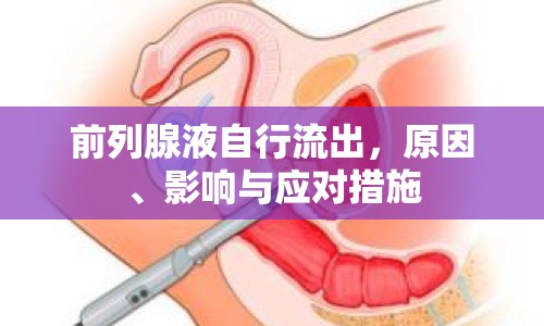 前列腺液自行流出，原因、影響與應對措施