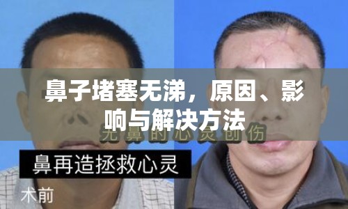 鼻子堵塞無涕，原因、影響與解決方法