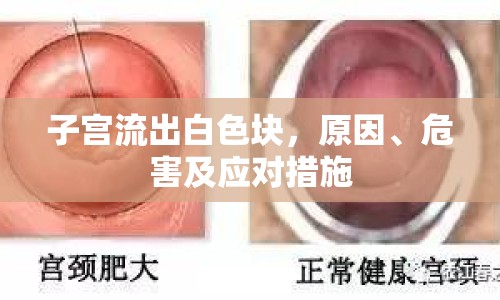 子宮流出白色塊，原因、危害及應(yīng)對(duì)措施