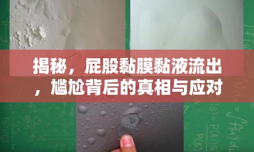 揭秘，屁股黏膜黏液流出，尷尬背后的真相與應(yīng)對方法