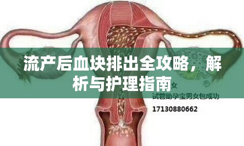 流產(chǎn)后血塊排出全攻略，解析與護(hù)理指南