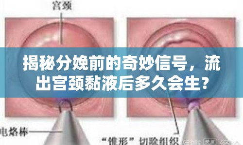 揭秘分娩前的奇妙信號，流出宮頸黏液后多久會生？