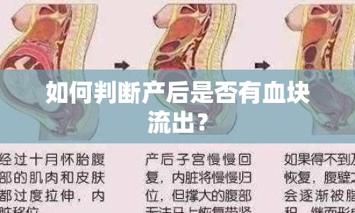 如何判斷產(chǎn)后是否有血塊流出？