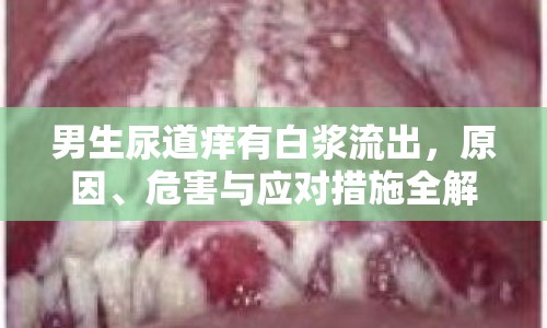 男生尿道癢有白漿流出，原因、危害與應(yīng)對(duì)措施全解析
