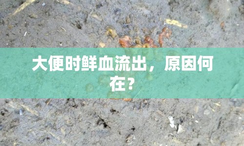 大便時(shí)鮮血流出，原因何在？