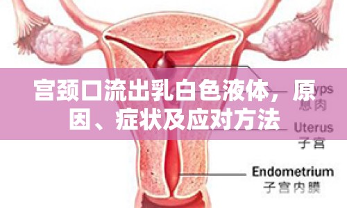 宮頸口流出乳白色液體，原因、癥狀及應對方法