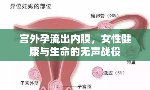宮外孕流出內(nèi)膜，女性健康與生命的無聲戰(zhàn)役