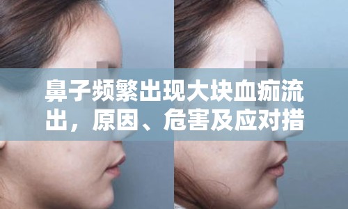鼻子頻繁出現(xiàn)大塊血痂流出，原因、危害及應(yīng)對(duì)措施
