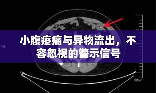 小腹疼痛與異物流出，不容忽視的警示信號